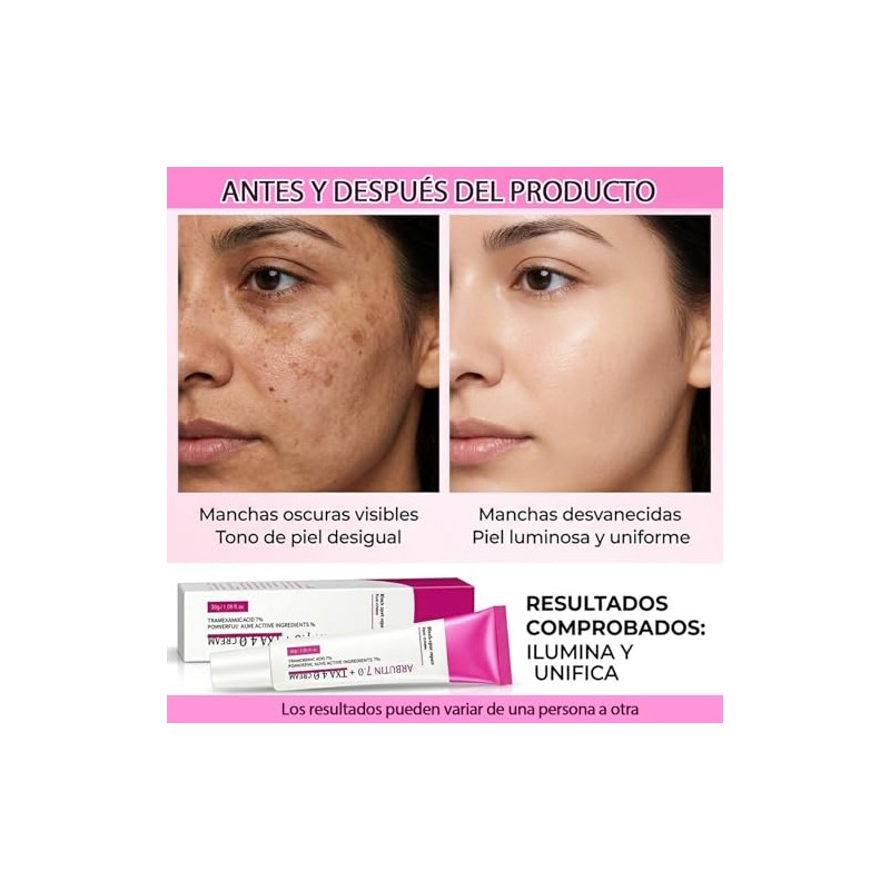3pcs Crema Despigmentante Arbutina Ácido Tranexámico Aclarante Facial Manchas Oscuras