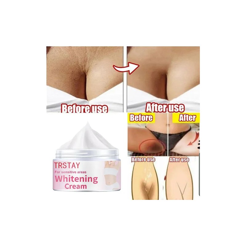 Crema Aclaradora Hidratante For La Piel Más Nueva De Melani
