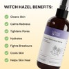 MyMagicHealer Organic Witch Hazel Spray | Calming Flare Care |
