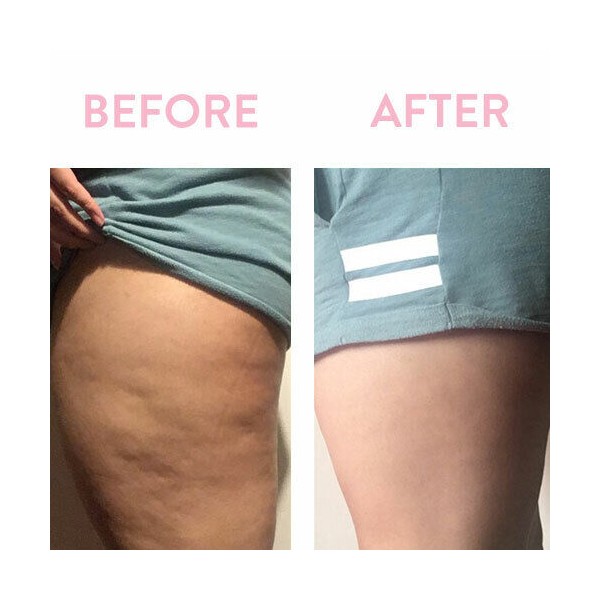 Chakra Anti Cellulite Massage Oil-Tones Skin & Helps Shrinks Stretchmarks