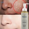 BIODERMAX LACTOBIONIC ACID EXFOLIATING GEL RADIANT SKIN 150ML