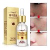 Serum Facial Vitamina C Puntos Negros Cierra Poros Aclara