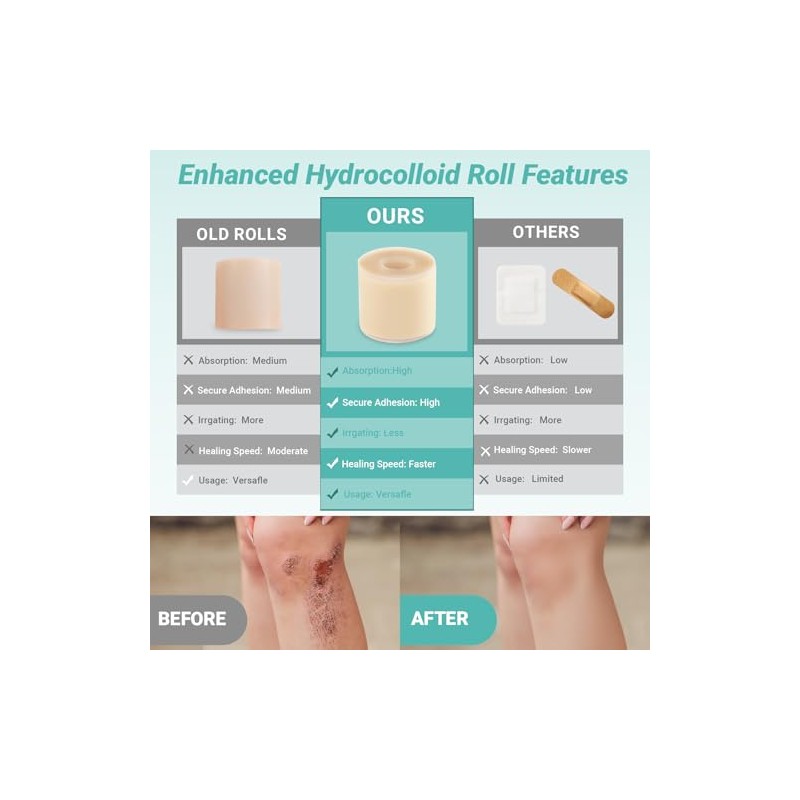 Hydrocolloid Roll for Wound Care - Flexible and Waterproof Bandages