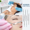 JPNK Blackhead Remover Comedone Extractor Acne Removal Kit..