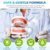 Smddx Smddx 4pcs Teeth Whitening Pen,Teeth Whitening Gel Essence-Fast-Acting Stain