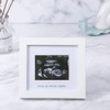 IHEIPYE Baby Sonogram Photo Frame - 1st Ultrasound Picture Frame