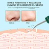 Limpiador Facial Ultrasnico,Sebami Exfoliacin facial ultrasnica Skin Scrubber USB Recargable,