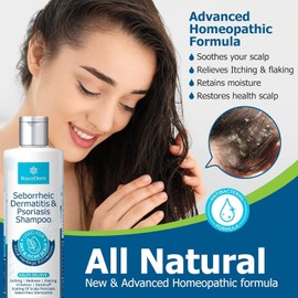 Roycederm Champú para la psoriasis, dermatitis seborreica, foliculitis y caspa, tratamiento para cuero cabelludo con picazón y seco, 250 ml