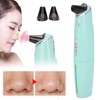 Electric Hot Compress Blackhead Acne Removal Machine Face Pore Cleaner