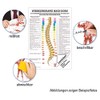 Bolt Mini poster Therapy Medical Educational Anatomy 34x24 cm mittel