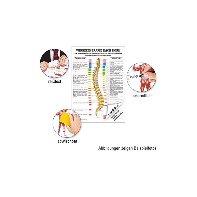 Bolt Mini poster Therapy Medical Educational Anatomy 34x24 cm mittel