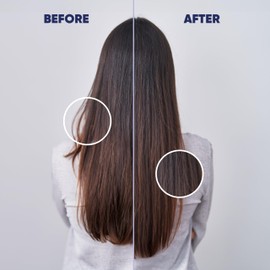 MOERIE Ultimate Hair Boost Serum for Natural Hair Regrowth & Thickening - Anti Thinning & Hair Loss Treatment for Women - Rapid Hair Growth Products - Scalp Oil Alternative - 1.69 fl oz / 50 ml