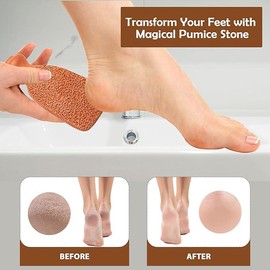 Pumice Stone for Feet Lasts 5+ Years Foot Exfoliator Scrubber Callus Remover Made of Natural Terra-Cotta Exfoliate Smoothing Gift Manicure Nail Nail Care Exfoliating Cutics Nail Art