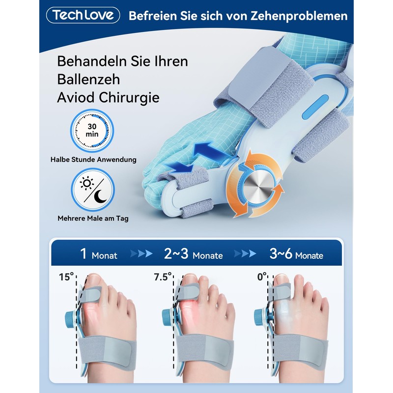 Tech Love Hallux Valgus Correction Fixing Plate Upgrade Double Tension