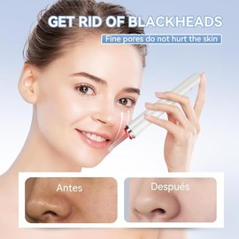 ANLAN Peeling Ultrasonico Facial, Skin Scrubber, Espatula Ultrasonica Facial, Ultrasonico Facial, Roja Y Azul Led, Ems Antiedad Arrugas, Exfoliador Li