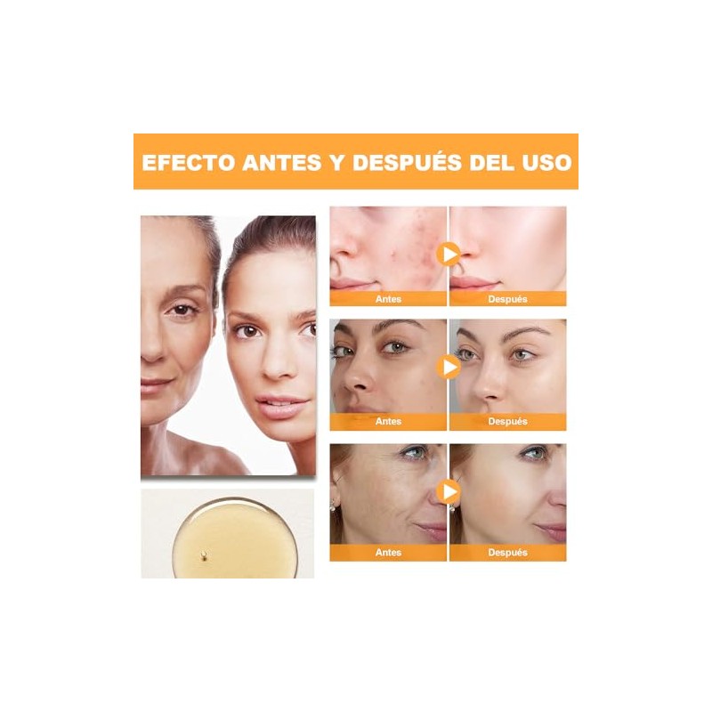 Ácido Glicólico 7% Solución, Exfolia, 240 ml (A)