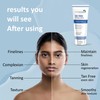 7 DAYS De- Tan Removal Cream | De- Tan Removal