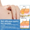 # Aq Crema Eliminadora De Verrugas 20 G - Para