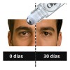 Roll On Anti Ojeras Oscuras Anti Bolsas Inflamadas Om Style