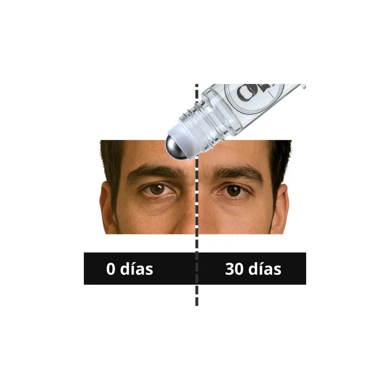 Roll On Anti Ojeras Oscuras Anti Bolsas Inflamadas Om Style