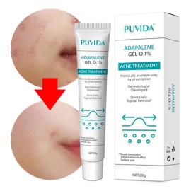 Gel Contra Barros Y Espinillas Tipo De Piel Con Acné, 20g