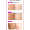 Crema Reparadora De Manchas Oscuras Tranexamic Para Rostro Z