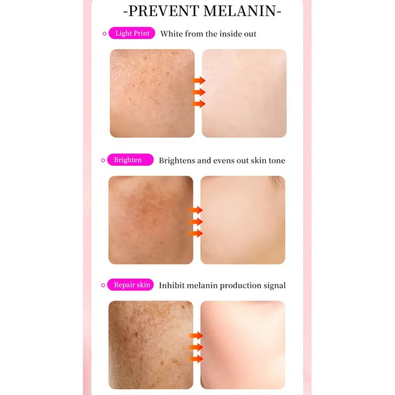 Crema Reparadora De Manchas Oscuras Tranexamic Para Rostro Z