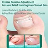 Professional Ingrown Toenail Corrector Kit - Curved Nail Strips &
