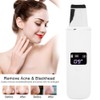 Ultrasonic Face Skin Scrubber Facial Cleanser Exfoliating Remove Blackheads Pimples