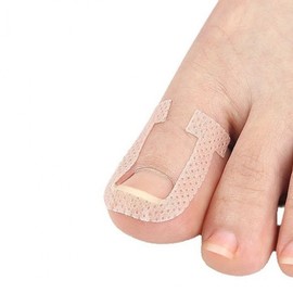 Ingrown Toenail Corrector Tape - Self-Treatment Band for Ingrown Big Toenail Care Prevention