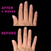 Perfect Formula Nail Collection - The Perfect Keratin Nail Treatment
