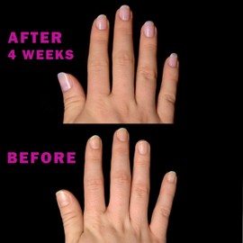 Perfect Formula Nail Collection - The Perfect Keratin Nail Treatment Manicure - A "Suit of Armor for Your Nails" - 4 pieces.