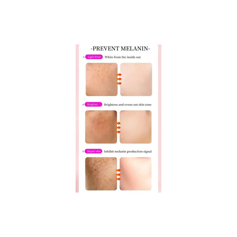 Crema Facial Antimanchas Antimanchas Melasma Paño 30 G