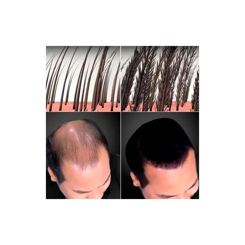 Sustituto Cabello Micro Fibras Naturales Capilares Keratina