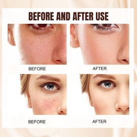 45ml Correcting Cream with SPF 25,Centella Asiatica Color,Lightweight Tinted Moisturizer,Full Coverage Foundation Hybrid,Brightening Formula Minimizes Pores & Evens Skin Tone,Long-Lasting Natural Glow