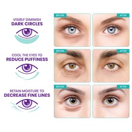 Stylia Stylia Under Eye Patches for Dark Circles and Puffy Eyes (30 Pairs), Collagen Eye Mask for Puffiness with Retinol, Vitamin C, Hyaluronic Acid, Eye Gel Pads for Dark Circles and Puffiness