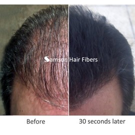 Samson Hair Fibers for Thinning Hair - 100% Undetectable Natural Formula - Completely Conceals Hair Loss in Seconds. Covers bald spots. Thicken your hair instantly - 25 Gram Container (BROWN)