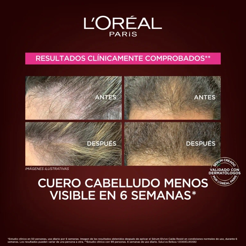 Mascarilla L'oréal Paris Elvive Caída Resist Aminexil 300gr