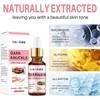 Dark Knuckle Whitening Serum, Whitening Serum Hand Knuckle Glow Serum