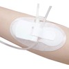 40 adesivi per catetere statlock Foley, per catetere singolo, doppio