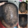 Locion Al 7 Crecimiento Cabello Fortificado 60ml 6 Meses