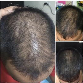 Locion Al 7 Crecimiento Cabello Fortificado 60ml 6 Meses