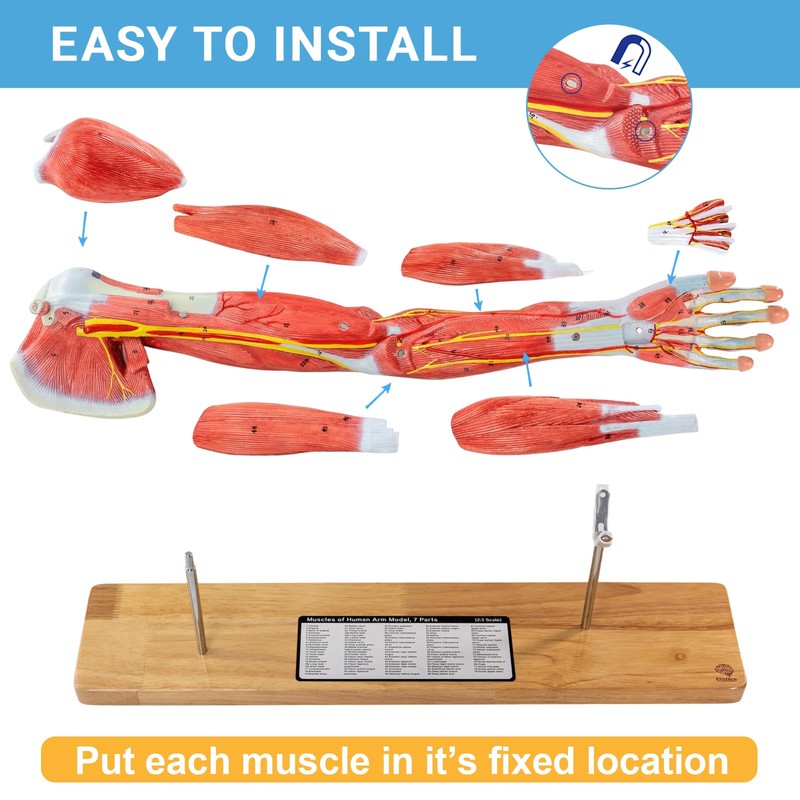 EVOTECH SCIENTIFIC Human Muscular Arm Anatomy Model, 7 Part 2/3