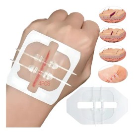 Tiras De Cierre Heridas De Emergencia,vendaje Puntada 4pcs