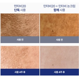 Zolopix Mintavi 20 26ml Ampoule / 졸로픽스 민타비20 26ml 앰플