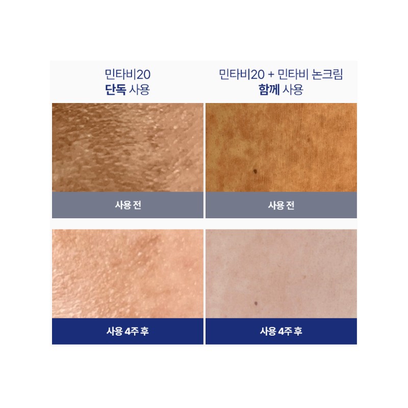 Zolopix Mintavi 20 26ml Ampoule / 졸로픽스 민타비20 26ml 앰플