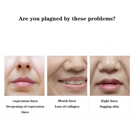 Nasolabial Folds Patches, Microcrystalline Nasolabial Folds Removal Mask, Hyaluronic Acid Microcrystalline Lifting Decree Patch, Face Wrinkle Removal Lift Mask for All Skin Type (1 Box)