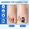 4pcs Anti-Slip Hammer Toe Corrector, Adjustable Toe Straighteners, Toe Splint