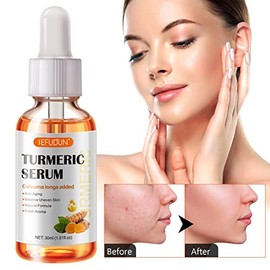 NIFEISHI- 【Ingredientes puramente naturales】El suero corrector de manchas oscuras de cúrcuma está formulado con ingredientes totalmente naturales conocidos por nutrir la piel, como la cúrcuma y el ace