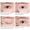 Eye Massage Cream Remove Dark Circles High Frequency Vibration Electric